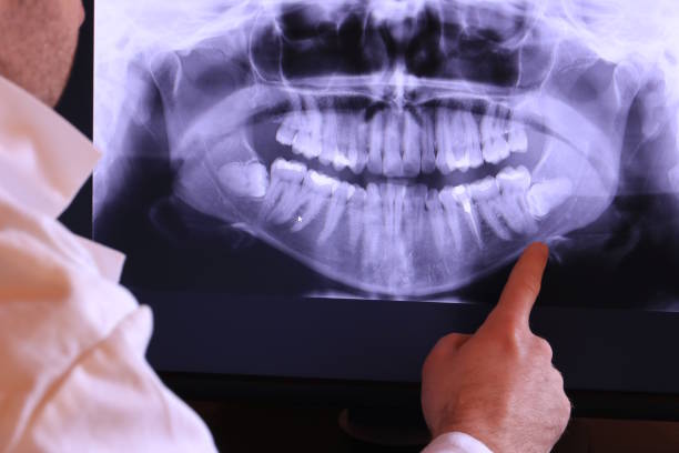 Best Emergency Tooth Extraction in North Edwards, CA