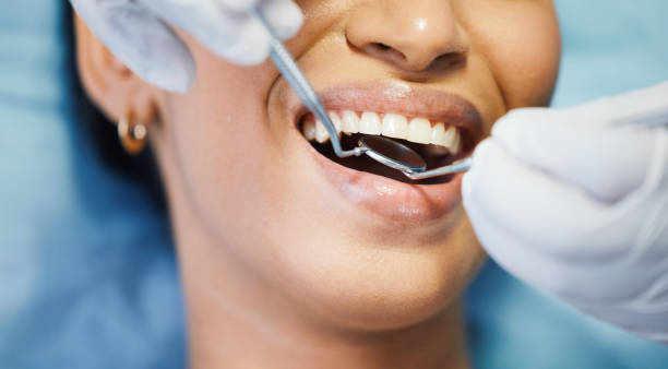 Best Emergency Dental Care for Broken or Chipped Teeth in North Edwards, CA