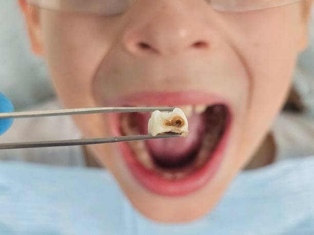 Best Same-Day Emergency Dental Services in North Edwards, CA